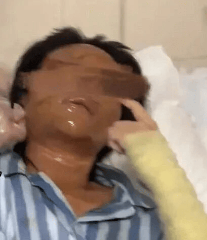 女主播被不明包裹炸伤毁容,警方通报